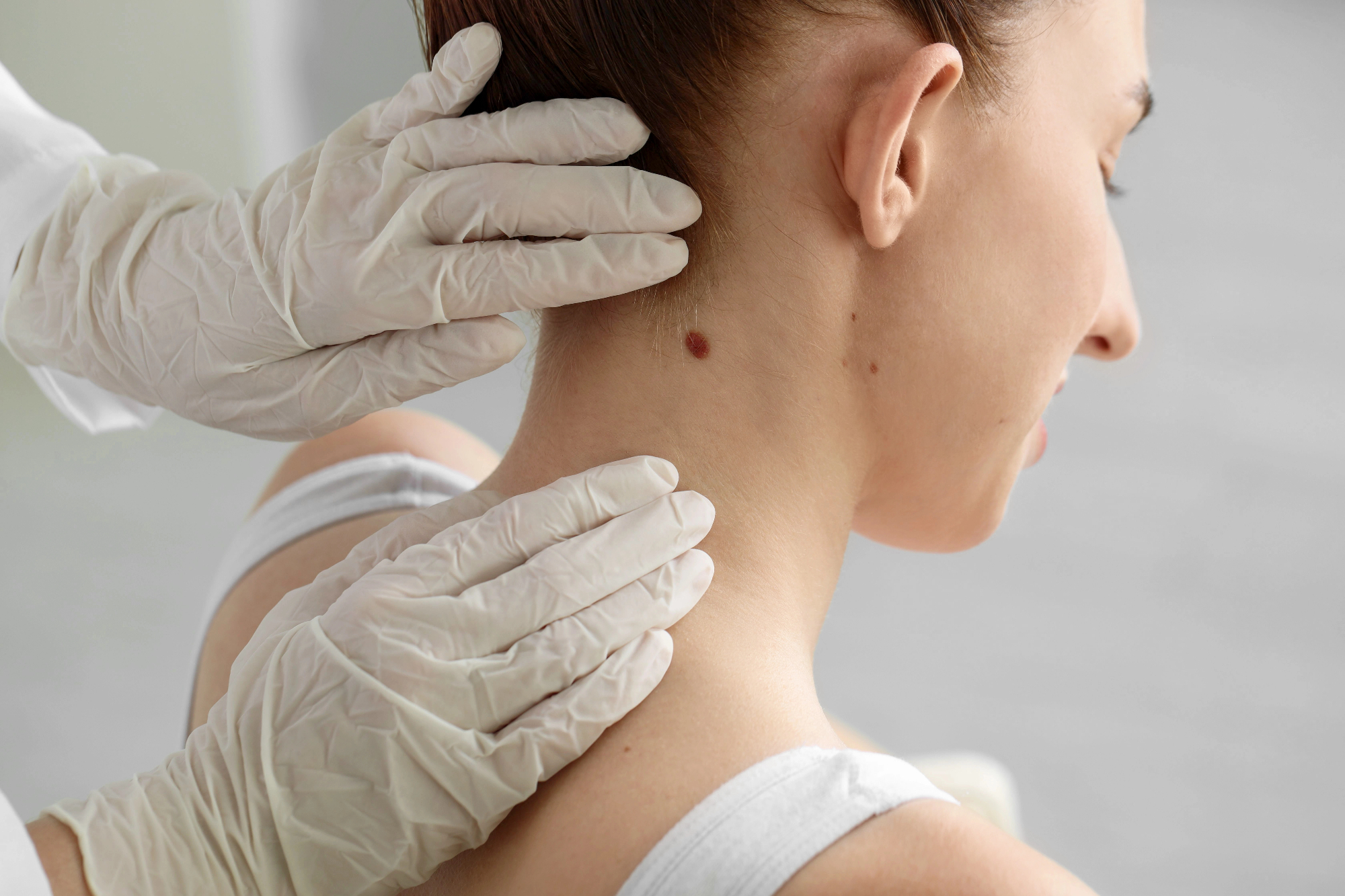 Dermatologija mi je pomagala rešiti težave s kožo